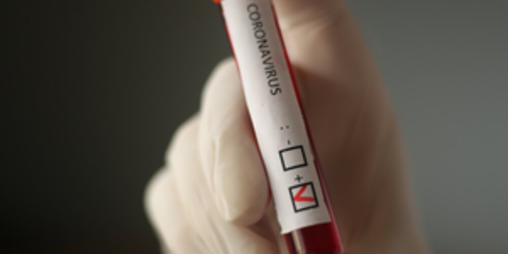 Press release: ITIC warns on the importance of checking crew COVID-19 tests